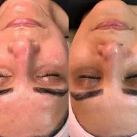 پاکسازی و فیشال پوست|خدمات آرایشگری و زیبایی|میبد, |دیوار