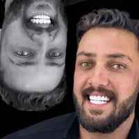 دندان/ارتودنسی/کامپوزیت/بلیچینگ/روکش