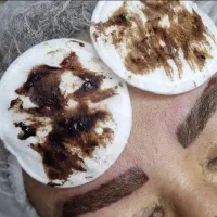 ریمو انواع تاتوهای صورت بدن به طور فوق تخصصی