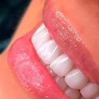 دندانپزشکی ایمپلنت ونییر کامپوزیت دندان