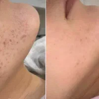 فشیال تخصصی