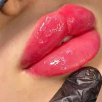 بلفاروپلاستی کاشت مو و ابرو نخ فیلر بوتاکس لیزر|خدمات آرایشگری و زیبایی|اندیشه, اندیشه فاز ۶|دیوار