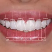 دوره آموزش دستیاری دیجیتال دندانپزشکی
