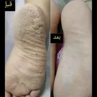 پدیکور درمانی مانیکور پارافین دست وپا|خدمات آرایشگری و زیبایی|کارون, |دیوار