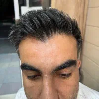 کلینیک تخصصی کاشت مو و ابرو با تضمین
