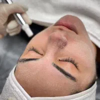 تخفیفات ویژه پاکسازی پوست.فشیال فقط 400|خدمات آرایشگری و زیبایی|شاهین‌شهر, نظامی|دیوار