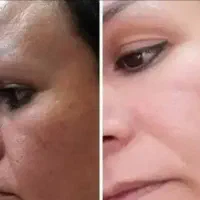 کرم معجزه شب اصل|آرایشی، بهداشتی، درمانی|دورود, |دیوار