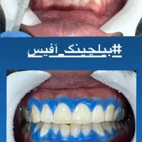 اموزش کامپوزیت|خدمات آموزشی|تهران, نازی‌آباد|دیوار