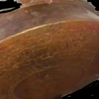 لگن‌مسی