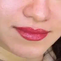 شیلدینگ