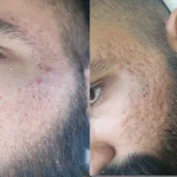 پوست و مو|آرایشی، بهداشتی، درمانی|زبرخان, |دیوار