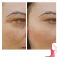 آف ویژه پی آرپی