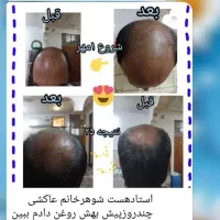 روغن رشد مو و روغن های درمانی|آرایشی، بهداشتی، درمانی|تربت جام, میرقوام الدین|دیوار