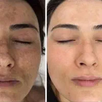 کرم معجزه۴۳ترکیبه کلاژن گیاهی سفید کنندی قوی|آرایشی، بهداشتی، درمانی|شیراز, سلطان آباد|دیوار