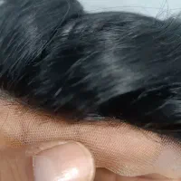 پروتز مو کاشت مو