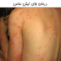 خدمات سمپاشی %100تضمینی %100تضمینی تمام نقاط تهران|خدمات نظافت|تهران, پاسداران|دیوار