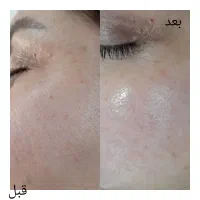 آموزش فیشال تخصصی با متد روز