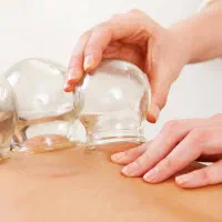 انواع حجامت با قیمت مناسب و کیفیت بالا|خدمات آرایشگری و زیبایی|مشهد, امام خمینی|دیوار