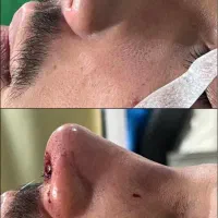 عمل بینی با ۲۵ میلیون|خدمات آرایشگری و زیبایی|گتوند, |دیوار