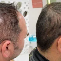 پی آر پی ممنوع