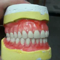 دندانسازی دندان مصنوعی