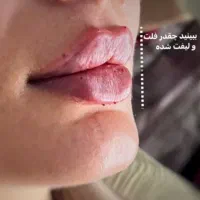 پانسمان وجراحی های سرپایی،ختنه،زگیل تناسلی|خدمات آرایشگری و زیبایی|اهواز, شریعتی جنوبی|دیوار