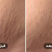 جشنواره زمستانی زیبایی