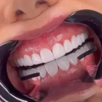 کامپوزیت دندان و آموزش