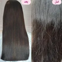 تخفیف ویژه. ..موخوره گیری فقط با ۲۹۸۰۰۰ هزار تومان