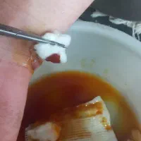 تزریقات،پانسمان،سرم،حجامت،فصدشبانه روزی درمنزل|خدمات آرایشگری و زیبایی|خرمآباد, |دیوار