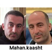 کاشت مو و ابرو اقساطی حتی با سفته|خدمات آرایشگری و زیبایی|مشهد, وکیل‌آباد|دیوار