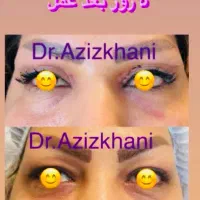 جشنواره تابستانی ۵۰٪ بلفارو پلاستی .تیپ پلاستی|خدمات آرایشگری و زیبایی|تهران, مهران|دیوار