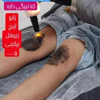 پاک کردن انواع تتو لاغری موضعی لیزر موهای زاید