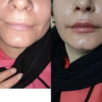 خدمات ژل