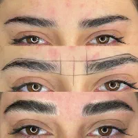 فیبروز و میکروبلید