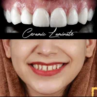 دندانپزشکی عصب کشی ترمیم کامپوزیت مناسب ترین قیمت|خدمات آرایشگری و زیبایی|مشهد, ده دی|دیوار