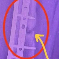 بهبود شکستگی استخوان و پوکی