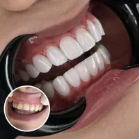 خدمات دندانپزشکی زیبایی