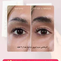 سرم رویش و تقویت ابرو|آرایشی، بهداشتی، درمانی|اصفهان, گلستان|دیوار