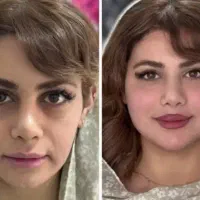 آفر ویژه ،تزریقات فیلر،بوتاکس850در منزلِ شما