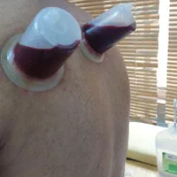 حجامت،فصد،زالو|خدمات آرایشگری و زیبایی|شیراز, سینما سعدی|دیوار