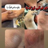 آموزش پیشرفته پدیکوروکفسابی