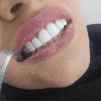 خدمات دندانپزشکی اقساط *بدون پیش پرداخت*