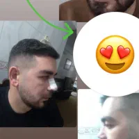 عمل بینی در فقط با۲۴تومن