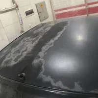 رفع آفتاب سوختگی بدون رنگ با سرامیک پنج سال