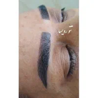 میکروبلیدینگ، فیبروز، تتو بدن، پرما لوکس