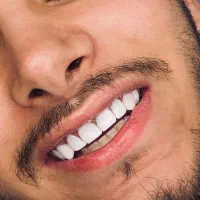 تخفیف ویژه کامپوزیت به مدت یک هفته|خدمات آرایشگری و زیبایی|اهواز, زیباشهر|دیوار