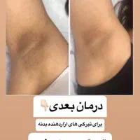 پاک کردن تتو ابرو و تتو بدن کربن ترابی بیکینی