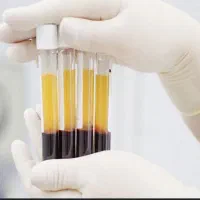 پی آرپی/مزوتراپی