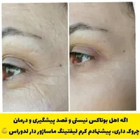 تنها کرم لیفت صورت(نمایندگی رسمی لاکچری کوین)|آرایشی، بهداشتی، درمانی|تهران, ابن بابویه|دیوار
